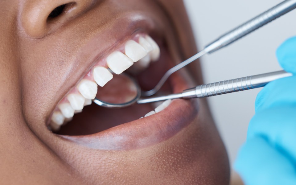 Extraction de dents de sagesse et autres chirurgies orales