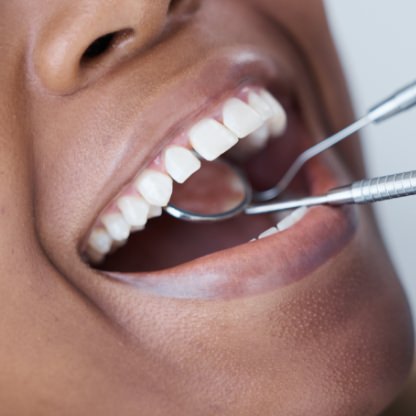CHIRURGIE ORALE | Centre Dentaire et d'Implantologie Haute-Beauce, Dentiste, La Guadeloupe 