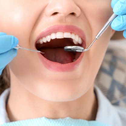 EXAMEN BUCCODENTAIRE ET DÉPISTAGE DU CANCER BUCCAL