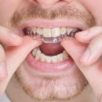 ORTHODONTIE | Centre Dentaire et d'Implantologie Haute-Beauce, Dentiste, La Guadeloupe 